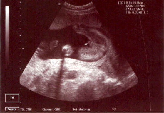 It's a Boy!